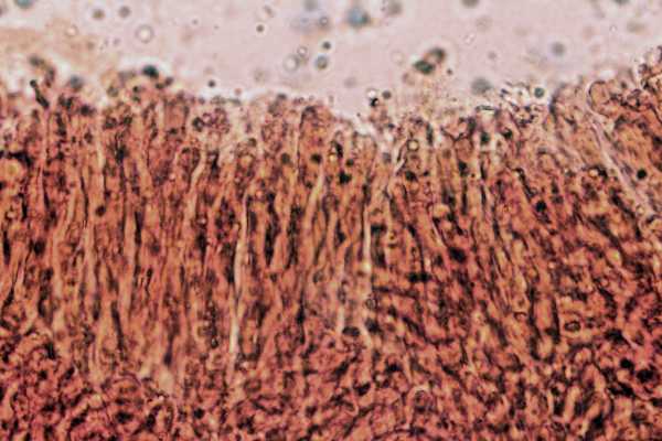 Gloeocystidiellum karstenii? (Laxitextum bicolor)